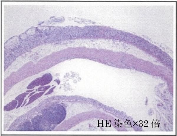 HE染色×32倍